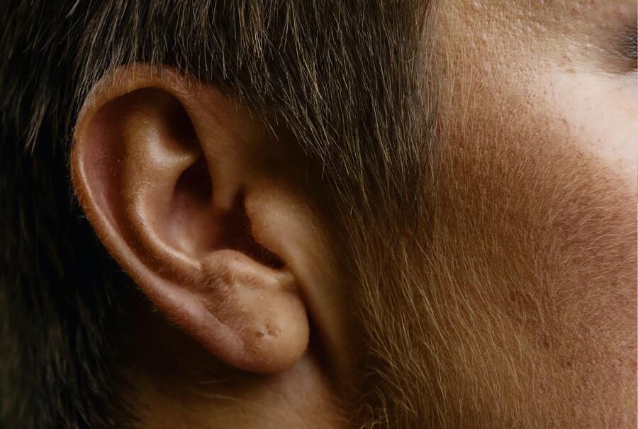 Tinnitus: qué es, qué efectos psicológicos tiene, y cómo se trata